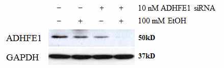 DLD-1 세포에 ADHFE1 siRNA 처리 및 Ethanol 처리, siRNA와 Ethanol을 함께 처리 한 후 western 결과