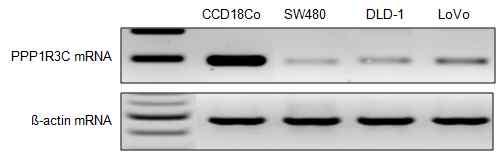 대장정상, 암 세포주에서 PPP1R3C의 발현