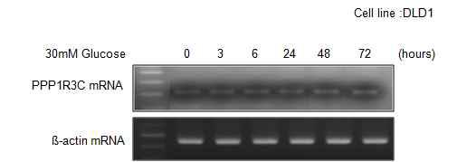 대장 암세포주에서 높은 글루코오즈 농도에 따른 발현의 증가