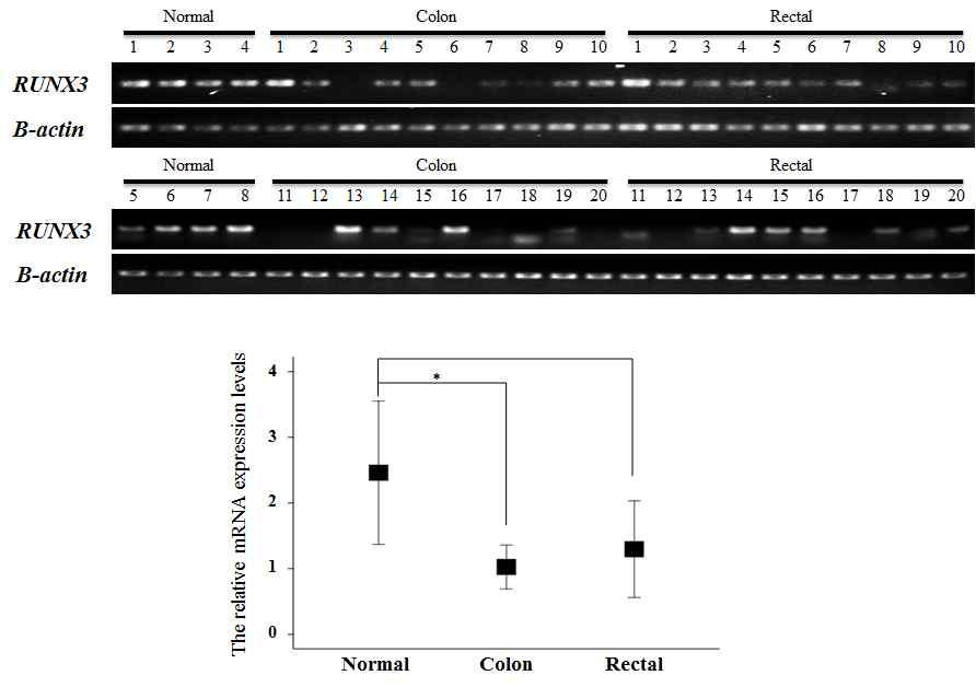 대장암 조직과 정상 대장 조직 및 직장 조직 사이에서 RUNX3의 mRNA 발현 정도