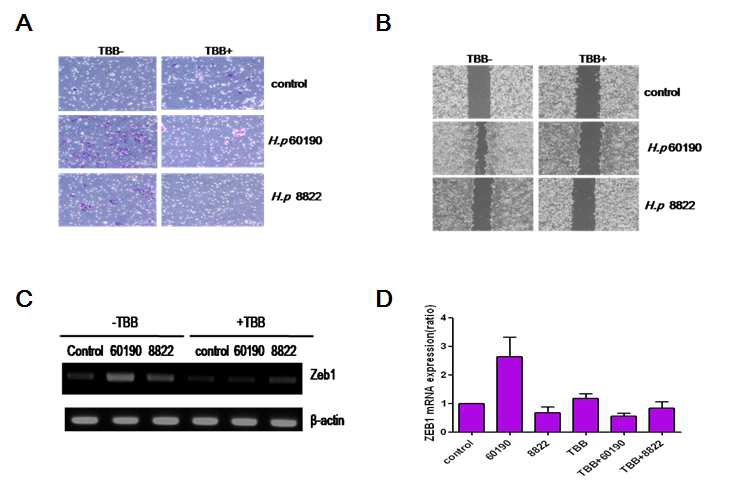 그림 4. H. pylori 감염에 따른 metastatic phenotype 및 EMT marker 유전자의 발현 변화