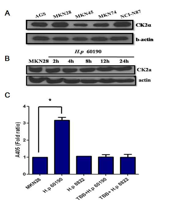 그림 3. 위암세포주 내 CK2 단백 발현과 H. pylori 감염에 의한 kinase activity 변화