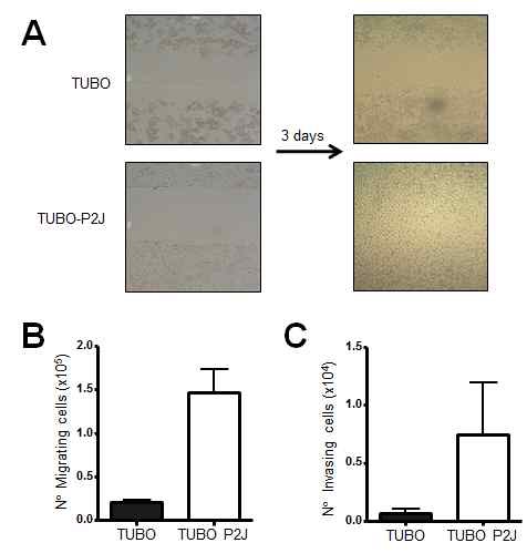 Figure 10. Migration and Invastion activities were increased in TUBO-P2J cells.