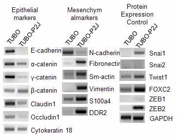 Figure 13. Gene expression profile of TUBO and TUBO-P2J