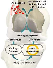 그림 1. 한의학의 골관절염 치료기전의 자음강화(nourishing Eum to reduce pathogenic Fire) 이론을 활용하여 연골하골 하부조직의 골수세포로부터 골형성 (osteogenesis) 및 연골형성 (chondrogenesis)를 유도시켜 골재형성을 유도시키는 모델.