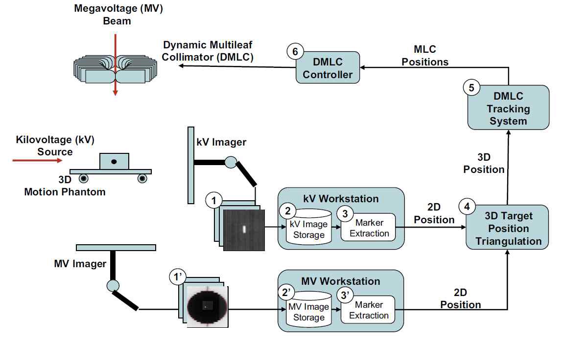 Figure 7. Flowchart of X-ray image-guided real-time dynamic multileaf collimator (DMLC) tracking