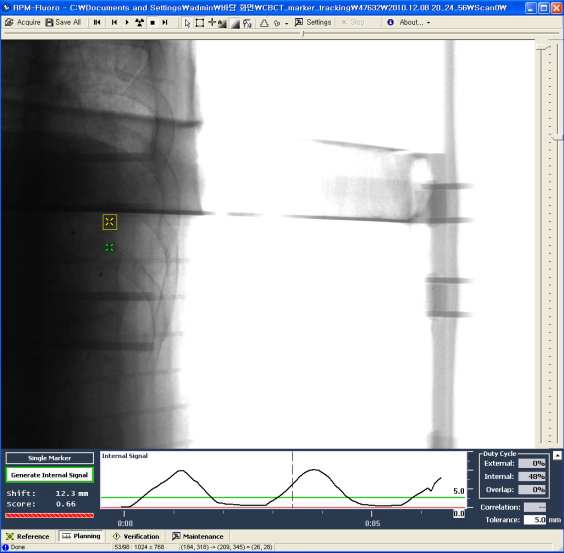 Fig. 11. Screenshot of the marker segmentation using RPM-Fluoro (Varian research tool).