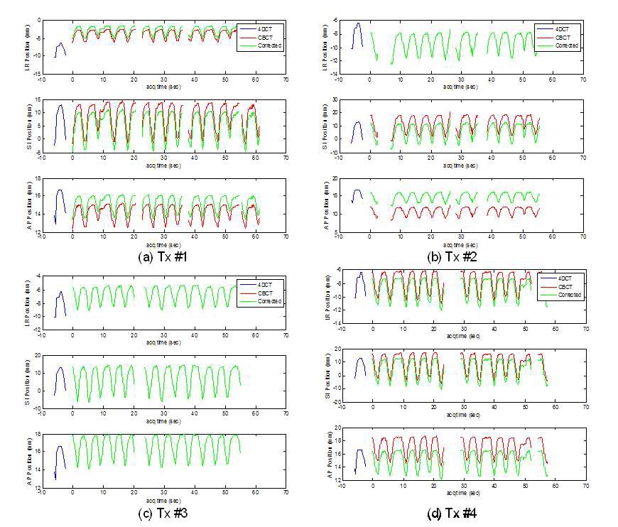 Figure 16. For 4 treatment sessions, the estimated trajectory from CBCT (red and green) was compared with the trajectory obtained from the 10 phase-binned 4DCT (blue).