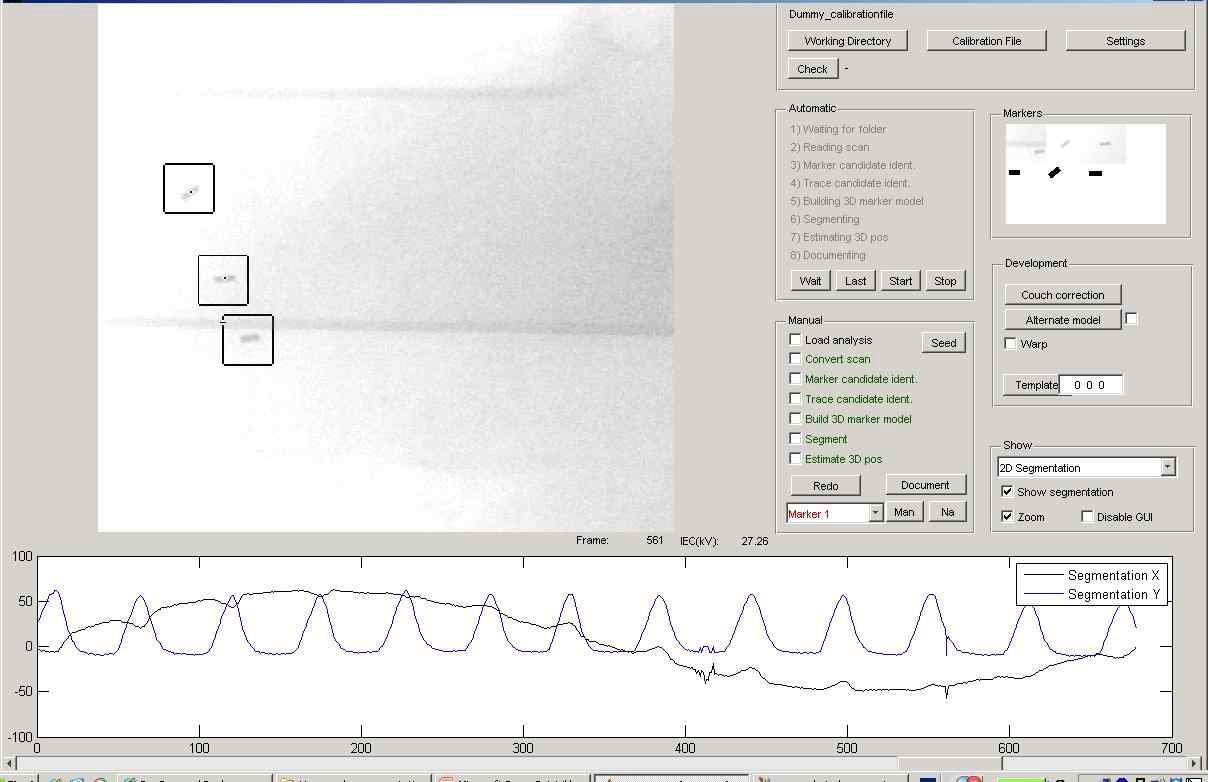 Fig 21. 3D template-based automatic marker segmentation program