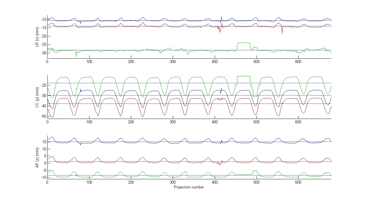 Fig 22. Result of automatic marker segmentation. Success ratio was > 95%.