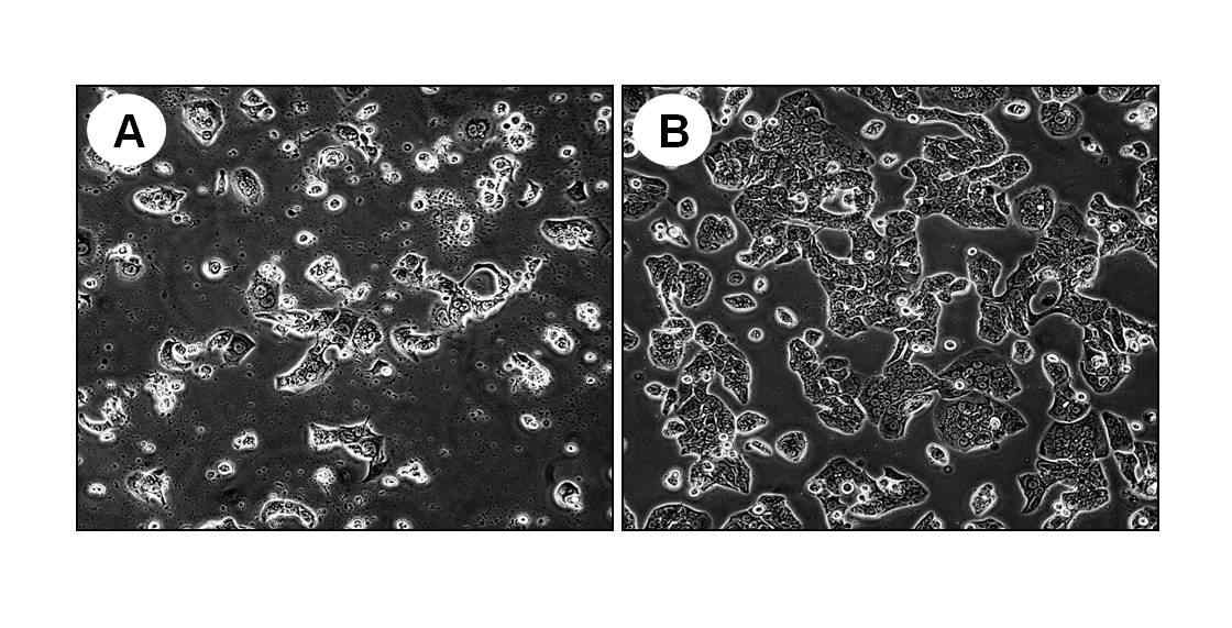 Fig. 4. 2DG stress상태에서 etoposide에 대한 내성 관찰