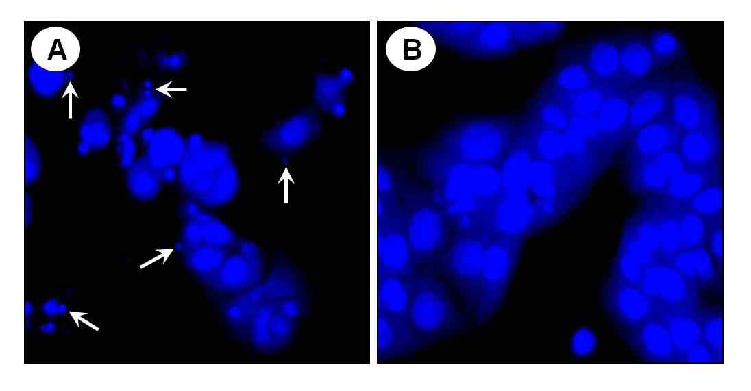 Fig. 5. 2DG stress조건에서 etoposide에 대한 apoptosis 유도 효과