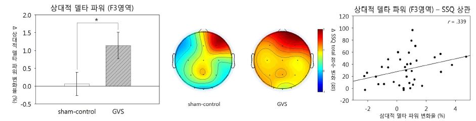 . F3영역의 상대적 델타 파워와 SSQ 점수와의 상관관계[우].
