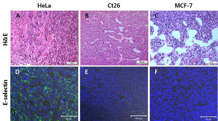 그림 7. 종양조직에서의 E-selectin 발현 확인.