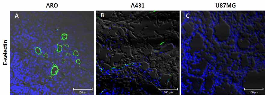 그림 8. 종양조직에서의 E-selectin 발현 비교 ARO (A), A431 (B) 세포주로 형성된 종양조직에서 E-selectin의 발현을 immunohistochemistry로 확인. E-selectin의 발현은 종양조직 전반에 걸친 것이 아니라 국소적 부위에서 나타났음. 이에 반해 U87MG 종양조직은 E-selectin의 발현이 나타나지 않았음(C).