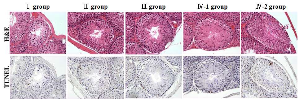 생쥐 고환 생식세포의 H&E와 TUNEL염색 결과. Apoptosis가 노출군에서 많이 관찰되었다.