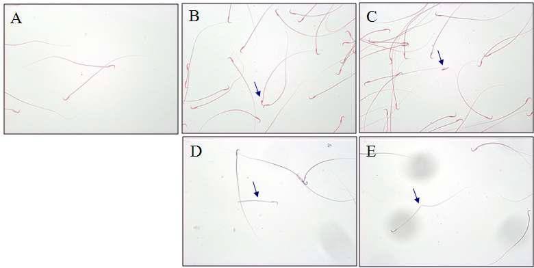 비정상 형태 정자. 정상 정자(A)이며, 미성숙 정자(B), 꼬리상실(C), 꼬리절단(D) 및 꼬리 이상(E)의 비정상 정자들이다. x400.