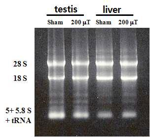RNA 분리. 고환과 간에서 RNA를 분리하였다. 28S와 18S의 비율이 2:1로 total RNA의 분리가 잘되었음을 보여준다. mRNA는 크기가 다양하여 total RNA에 전반적으로 분포되어 있다.