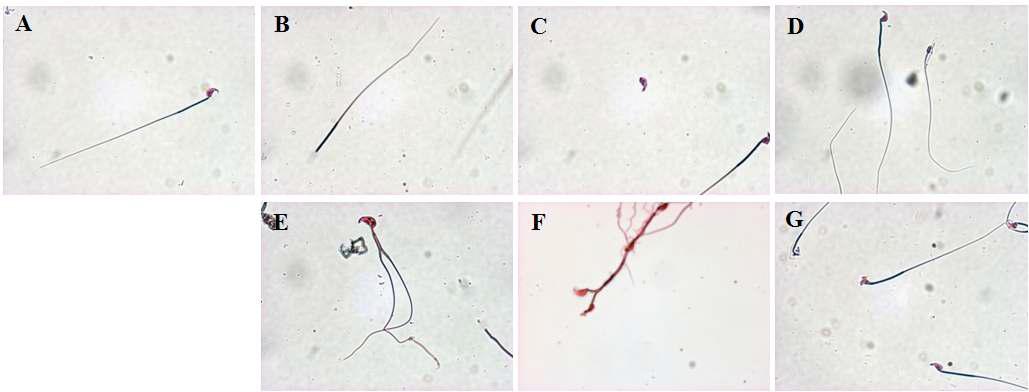 정자의 형태학적 관찰. 생쥐의 정상적인 정자(a)와 비정상적인 정자(b-g)이다.