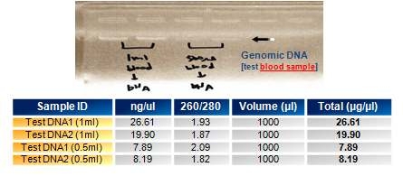 인체혈액시료로부터 DNA 추출 후 QC