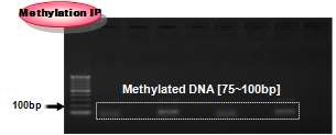 혈액시료로부터 methylated DNA 추출을 위한 IP 조건 확립