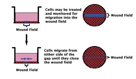 Wound healing assay를 이용한 cell migration 관찰 방법