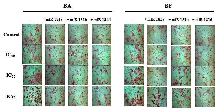 Transwell migration assay를 이용한 miR-181 inhibitor 처리에 따른 HepG2 세포주의 migration 변화