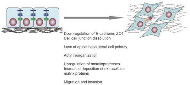 세포의 epithelial mesenchymal transition (EMT) 현상
