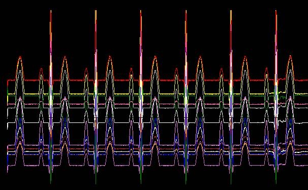 ECG Simulator를 이용한 ECG 파형: ECG 12lead 파형 확인