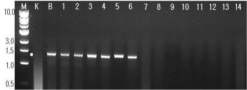 청견' (C. unshiu × C. sinensis) × '병귤' (C. platymamma)의 F1 분리 집단 내 웅성가임 연관 SCAR pMS 33U+pMS1462L 조합 특이 단일 밴드 검정