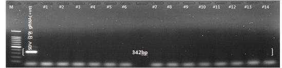 CTV 감염 판단용 특이적인　FW146+RV488 프라이머 조합(342bp)을 이용한 RT-PCR 증폭 산물의 전기영동