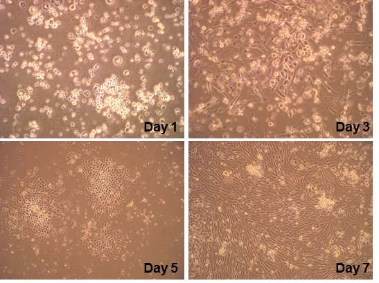 Cell growth patterns of primary TECs. Cell growth patterns of TECs were observed at 1, 3, 5 and 7 day after primary culture