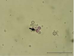 Blastodermal 유래의 PAS staining 양성세포, Allow means Pas staining positive cell Bar means 100 uM