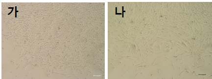 대퇴골의 골수(가)와 근육 유래(나) Mesenchymal stem cells의 분리 및 검정.