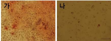 Osteocyte 분화 후, Alinzalin red staining positive 세포(가), Adipocyte 분화 후, Oil red O staining positive 세포(나).