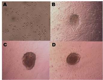 정원줄기세포 배양(10x), A: 고환에서 분리 직후 배양중인 세포, B: 초기 배양 3일 후 colony formation이 시작된 형태, C, D: 3, 5 단계 배양후의 집락.
