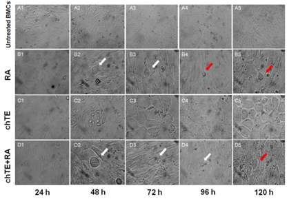 Morphology of RA, chTE or chTE+RA treated chBMCs at different time point after treatment. (A) untreated chBMCs at passage 3 ;(A1-A5) chBMCs were differentiated with RA for different of time. (a-d) differentiated for 24 h, (A1-D1) 48 h, (A2-D2) 72 h, (A3-D3) 96 h (A4-D4) and 120 h (A5-D5). (A1-A5; image magnifications are at ?00, B4-D4 and B-D5; image magnifications are at ?00 and ?00. White arrow; rounded cell. Red arrow; tail-like cells