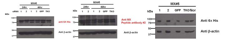 siRNA 처리 시간에 따른 Mx 단백질의 억제 효과실험