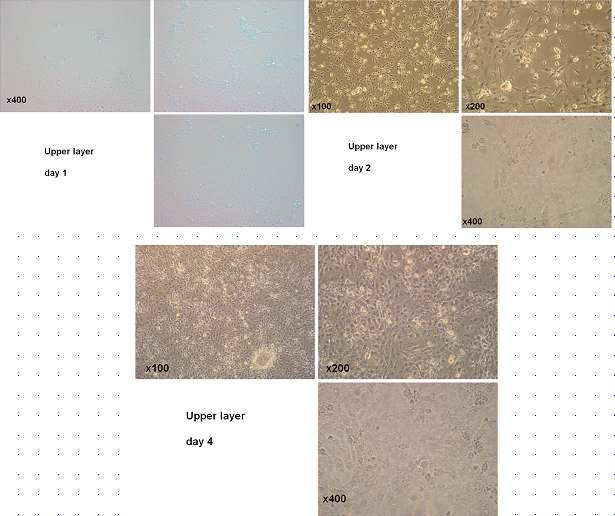 Bronchial epithelial primary cell morphology at day 1, 2, 4