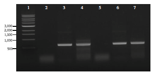 RT-PCR analysis of the pfk gene transcript produced by the wild-type strain. For the positive control, the presence of the expected amplicon when genomic DNA was included in the control sample demonstrated the reliability of the primer pair, PFKF-PFKR (lane 2). For the negative control, no amplicon was detected when total RNA that was treated with DNase I but was not reverse-transcribed served as the template, ensuring that residual genomic DNA had not contaminated the total RNA preparation (lane 3). The cDNA fraction obtained with the RT primer was used for subsequent PCR reactions with primer pair, PFKF-PFKR (lanes 4). DNA size markers in base pairs are indicated (lane 1).