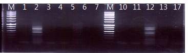 분리된 단포자(ASI 2782)의 RT-PCR 증폭산물.