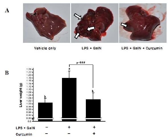 LPS에 의해 유도된 패혈증 모델에서 curcumin 에 의한 간 독성 억제 활성