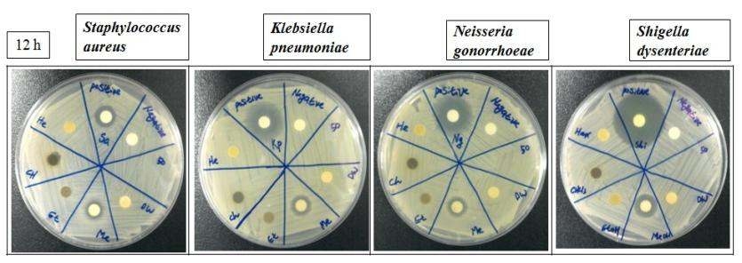 Gram-positive and Gram-negative bacteria measured using agar disk diffusion assay. Sa; Staphylococcus auerus, Kp; Klebsiella pneumoniae, Ng; Neisseria gonorrhoeae, and Shi; Shegella dysenteriae. Zone of bacterial growth inhibition shows antibacterial effects of extracts against the proliferation of the tested bacteria. Discs were treated with different extracts of 50mg/disc respectively.