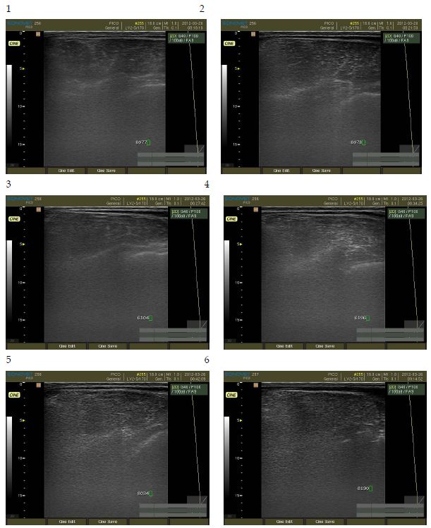 Ultrasonography analysis of Waiting Korean brindle cattle. (No. 1∼6)