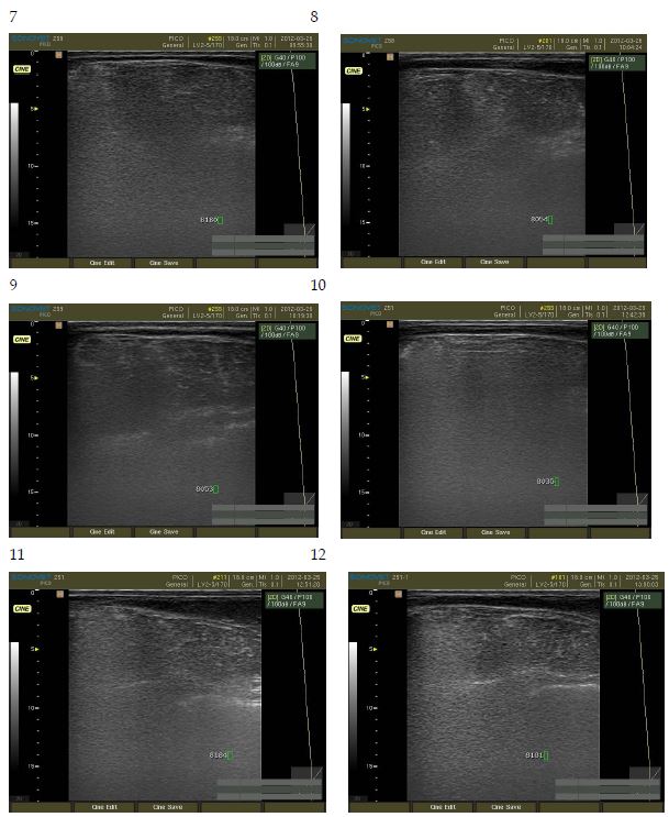 Ultrasonography analysis of Waiting Korean brindle cattle. (No. 7∼12)