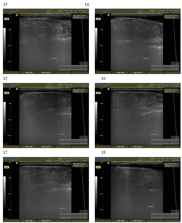 Ultrasonography analysis of Waiting Korean brindle cattle. (No. 13∼18)