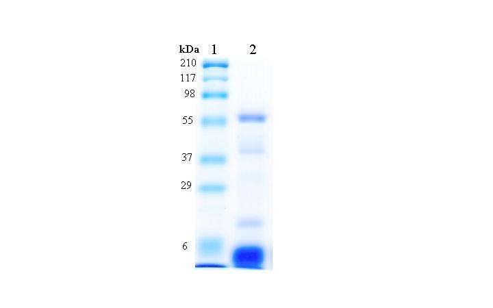 알칼리-산 추출법을 통한 보리 단백질의 SDS-PAGE 결과