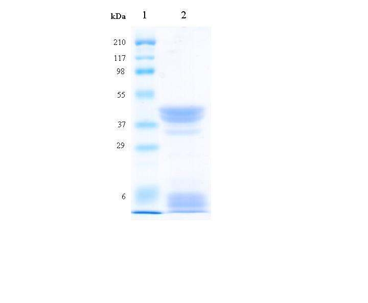 효소적 추출방법을 통한 보리 단백질의 SDS-PAGE 결과