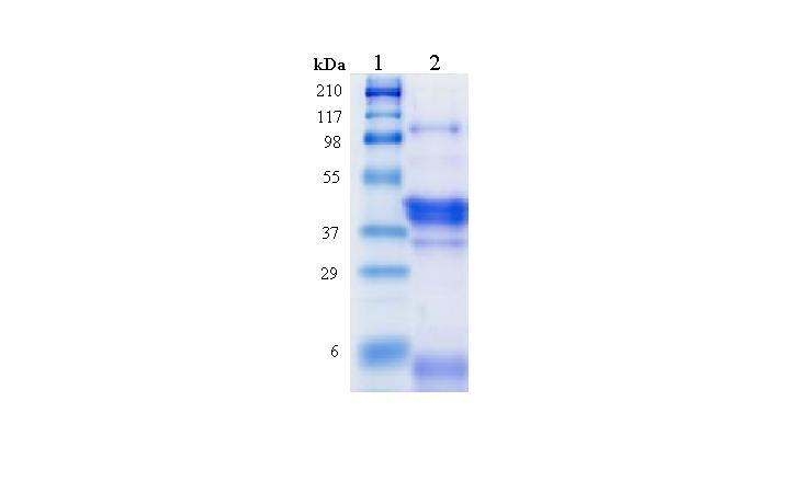 프로판올 추출 방법을 통한 보리 단백질의 SDS-PAGE 결과