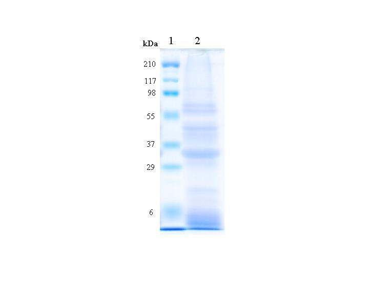 에탄올 추출 방법을 통한 보리 단백질의 SDS-PAGE 결과